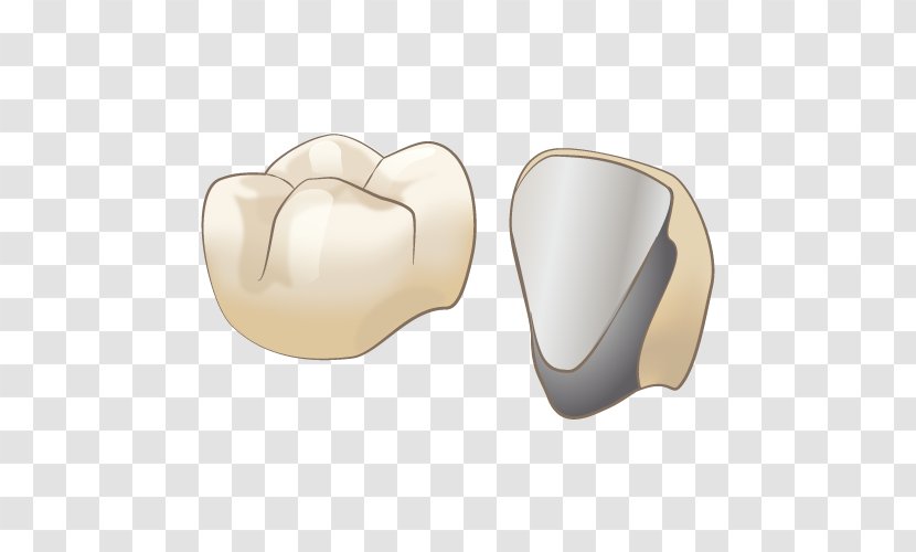 審美歯科 Dentist オールセラミック Therapy - Wisdom Tooth - Crown Transparent PNG