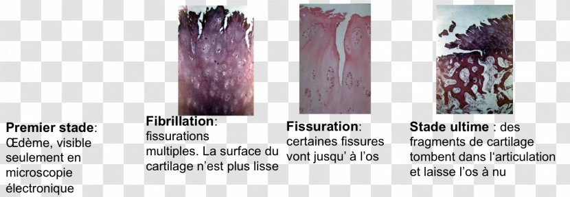 Hair Coloring Cartilage Joint Translation - Purple - Macrophage Transparent PNG