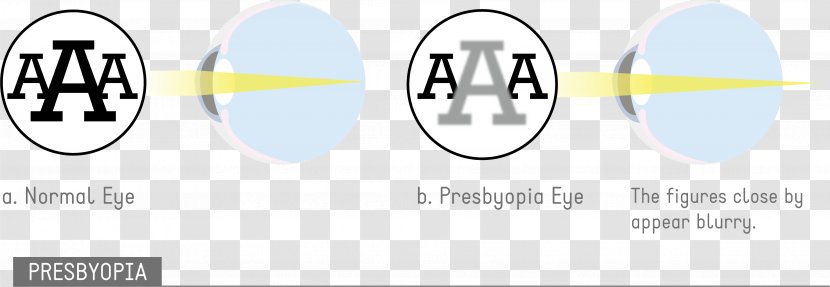 Astigmatism Eye Disease Visual Perception Amblyopia - Brand Transparent PNG