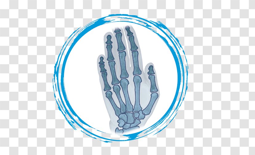 Novamedicum Dr Cabestany - Elbow - TraumatologoSabadell Traumatology Foot Thumb WristPartes De La Mano Y Muneca Transparent PNG
