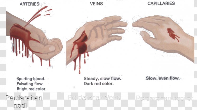 Bleeding Blood Circulatory System Thumb Heart - Cartoon Transparent PNG