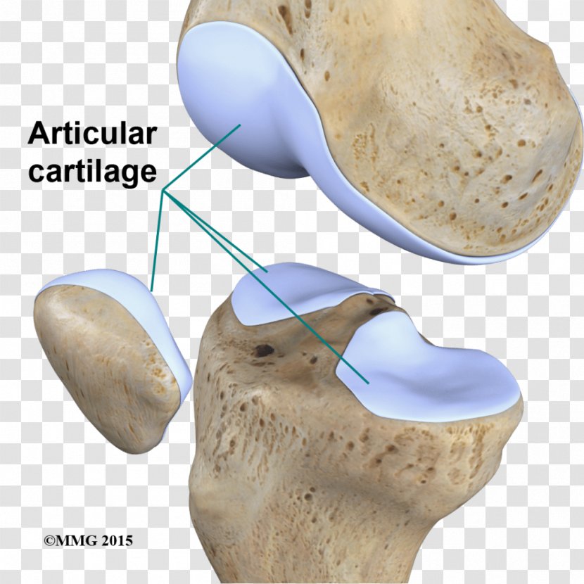 Articular Cartilage Damage Joint Repair Cartílago - Knee Arthritis - Motion Transparent PNG