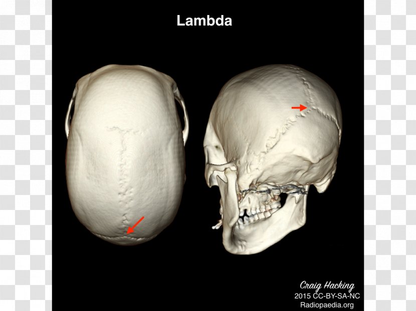 Anatomie Physiologie Für Die Physiotherapie Anatomy Skull Physical Therapy Idea - Bulletin Board Transparent PNG