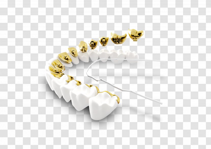 Fusion Orthodontics & Children's Dentistry Clear Aligners Dental Braces Lingual - Tooth - Physician Transparent PNG
