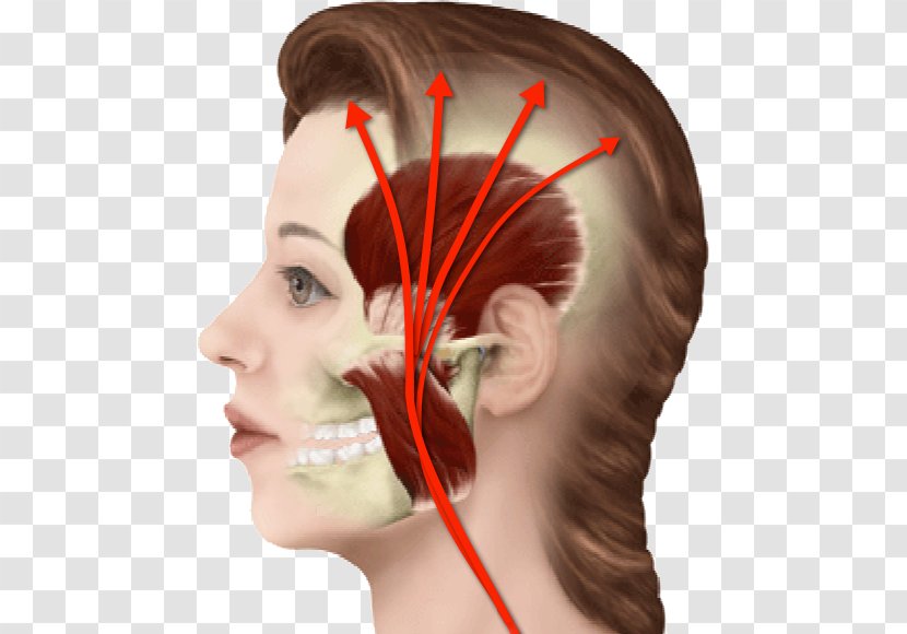 Myofascial Pain Syndrome Neck Orofacial Headache Face Transparent PNG