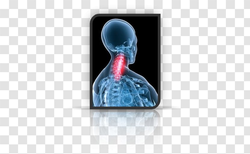 osteochondrosis neck pain