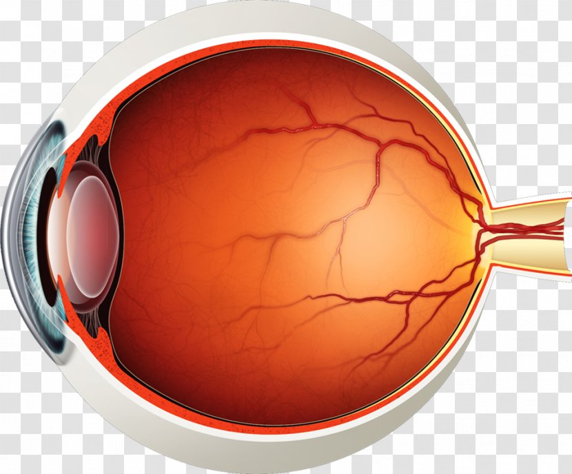 Vitreous Body Posterior Detachment Floater Retinal - Anatomy Transparent PNG