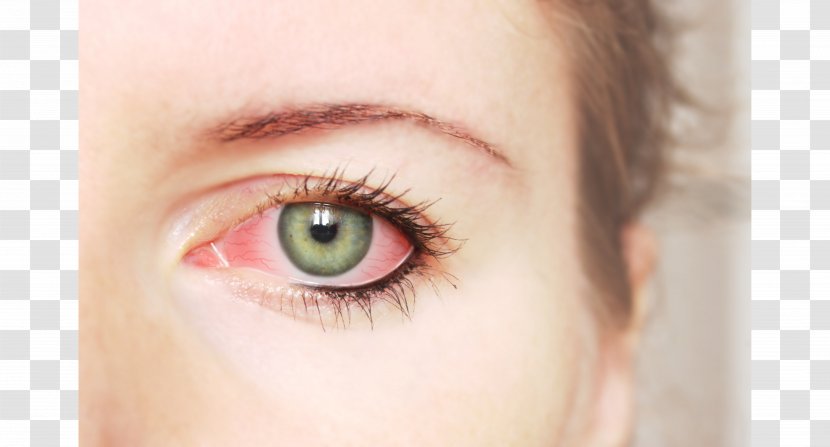 Eyelid Conjunctivitis Rheum Irritation - Silhouette - EYE CARE Transparent PNG