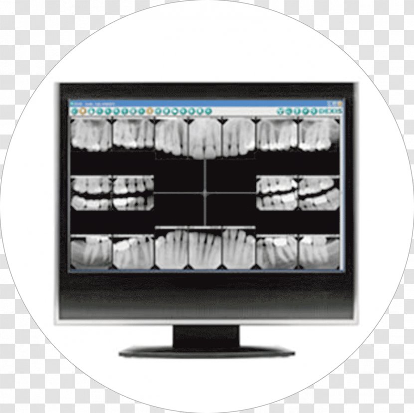 Dentistry Digital Radiography Tooth - Xray - Radiation Transparent PNG