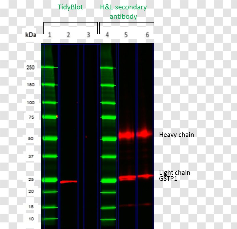 Immunoglobulin G Western Blot Light Chain Heavy - Protein L - Gstp1 Transparent PNG