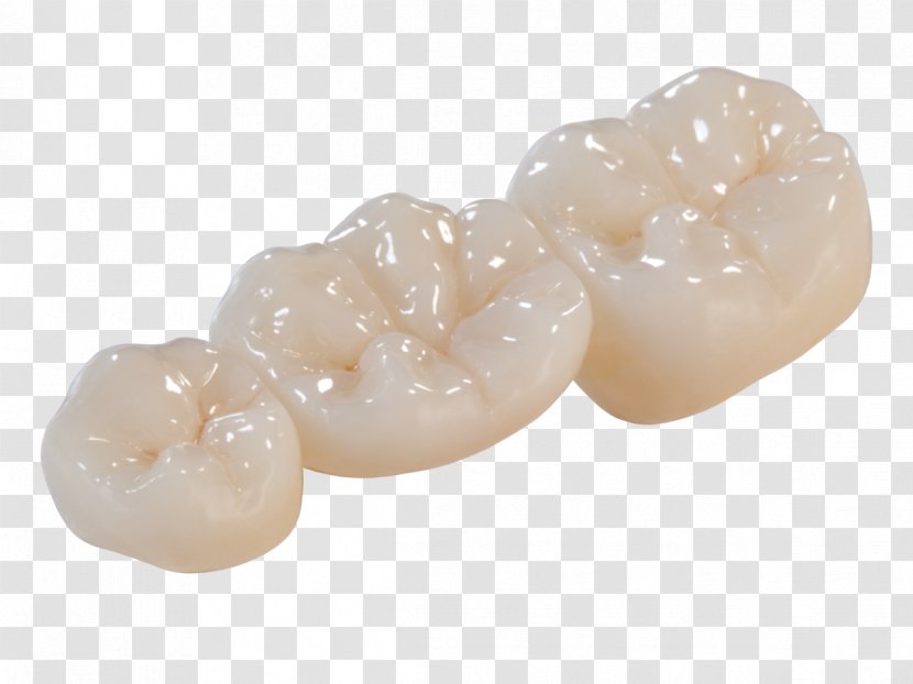 Crown Bridge Zirconium Dioxide Dentistry Dental Laboratory - Porcelain Transparent PNG