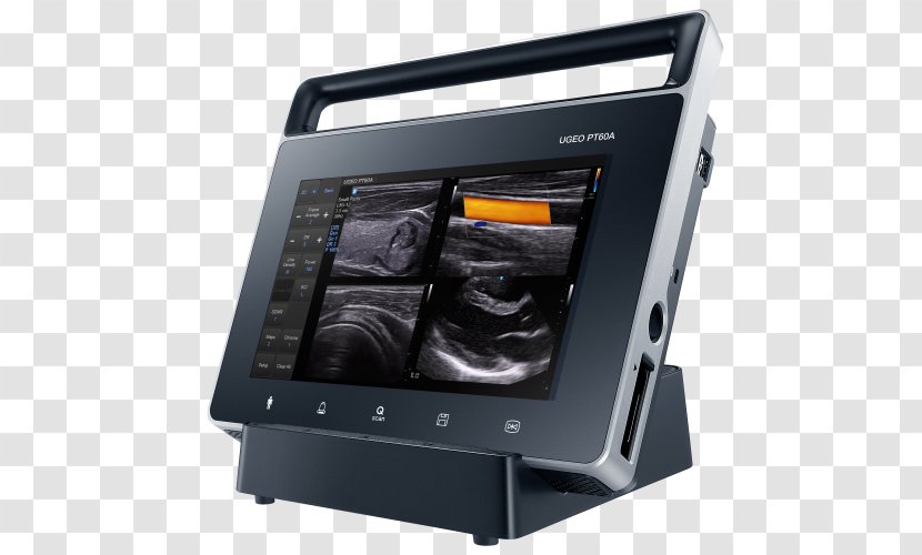 Ultrasonography Samsung Electronics Ultrasound Medicine - Cradle Transparent PNG
