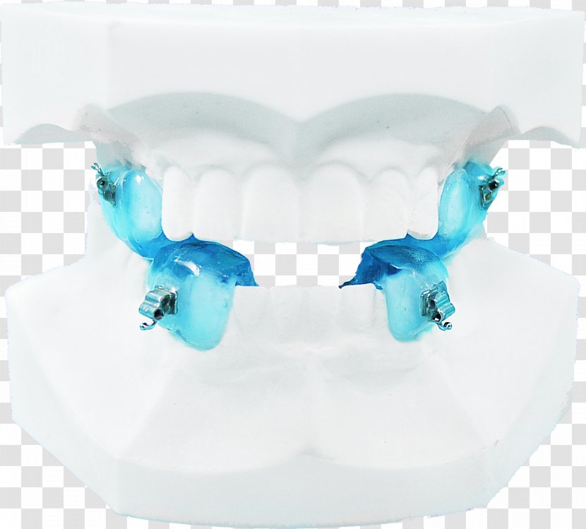 Jaw Orthodontics Dental Braces Twin Block Appliance Therapy - Laboratory - Rabbit Teeth Transparent PNG