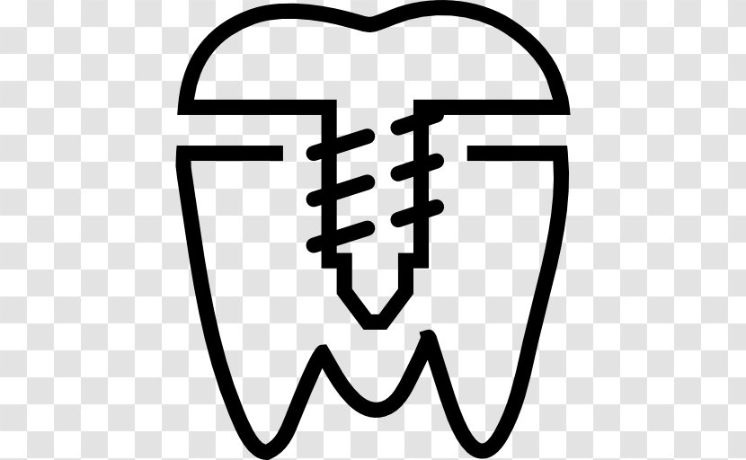 Dental Implant Dentistry Dentures - Black And White - Bridge Transparent PNG