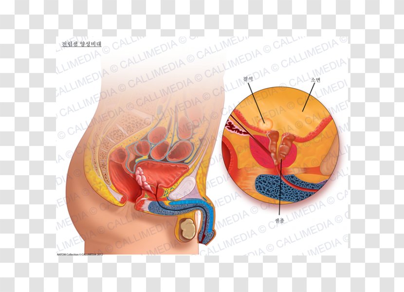 Prostate Genitourinary System Benign Prostatic Hyperplasia Urinary Bladder Urology - Frame - Gland Transparent PNG