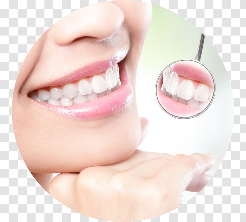 Tooth Whitening Cosmetic Dentistry Human - Veneer - Crown Transparent PNG