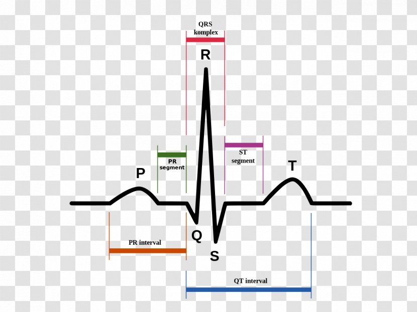 Electrocardiography Heart Sinus Rhythm QRS Complex Cardiac Arrest - Brand - Ecg Transparent PNG