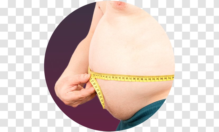 Obesity Dieting Cancer Health Surgery - Cartoon Transparent PNG