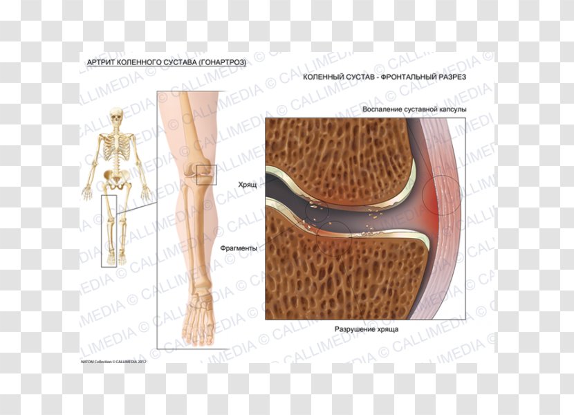 Shoulder Fibular Collateral Ligament Knee Shoe - Design Transparent PNG