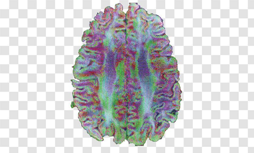 Brain Purple Medicine Transparent PNG