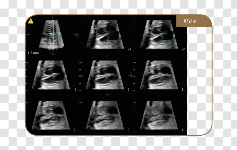 Ultrasonography TWICE Medical Equipment Medicine Magnetic Resonance Imaging - System Transparent PNG