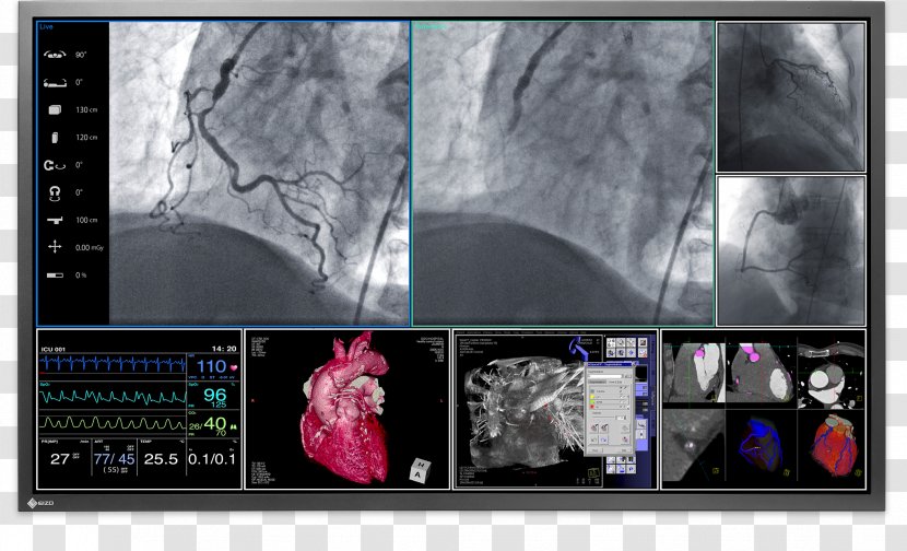 Medical Imaging Computer Monitors Eizo Nanao EIZO RadiForce MX191 Surgery - Radiography Transparent PNG