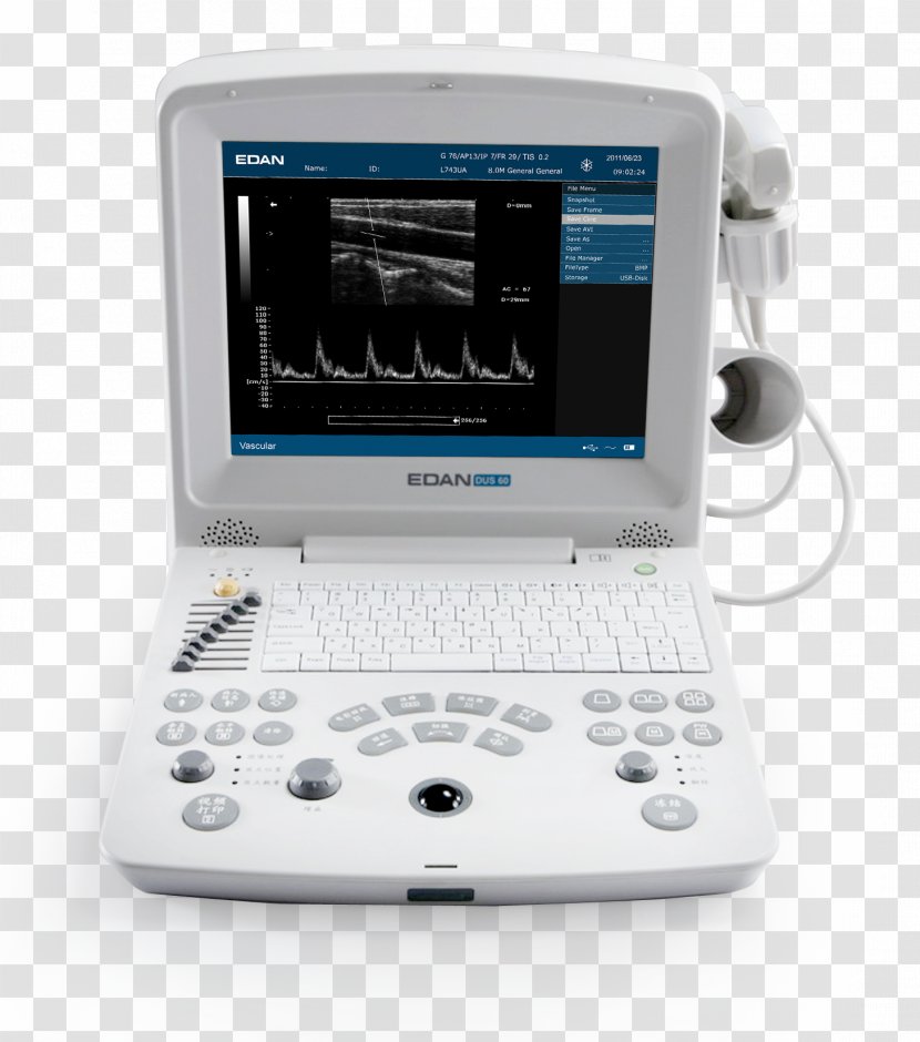 Ultrasonography Ultrasound Medical Imaging Electrocardiography Mindray - Obstetrics And Gynaecology Transparent PNG
