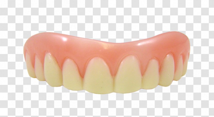 Veneer Dentures Dentistry Tooth Cosmetics - Jaw - Teeth Transparent PNG