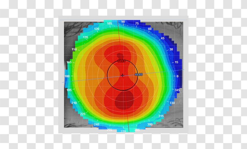 Corneal Topography Keratoconus Contact Lenses - Eye Transparent PNG