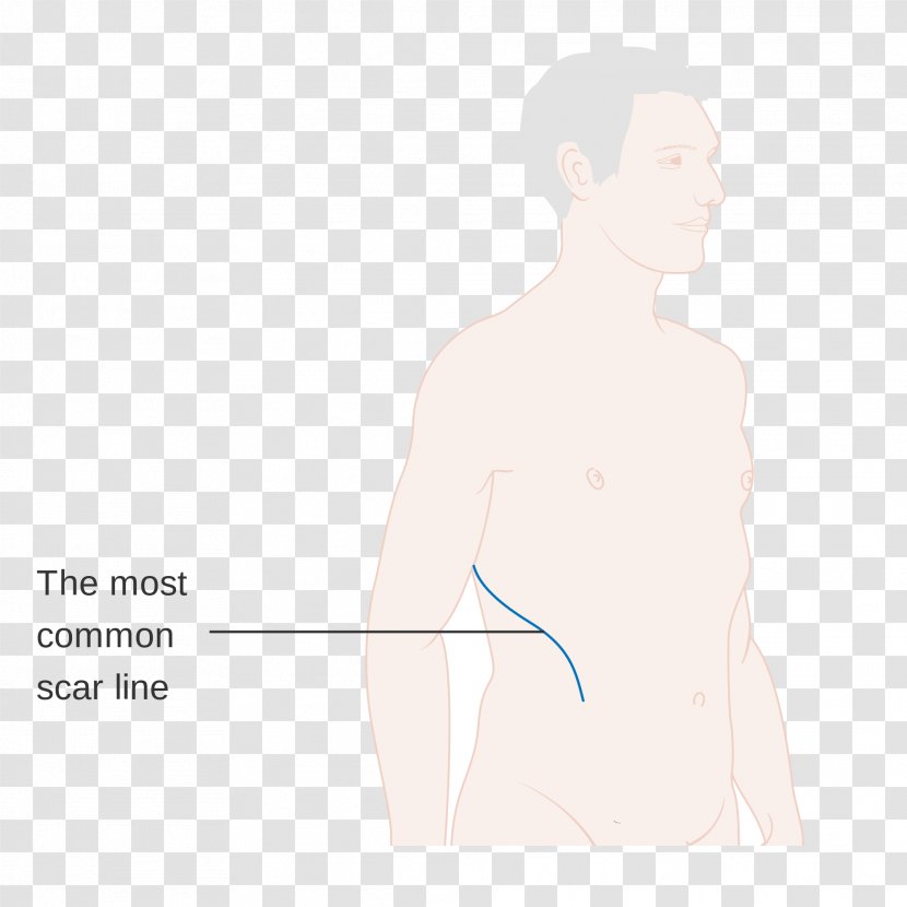 Thumb Drawing Surgery Scar - Flower - Lungs Transparent PNG
