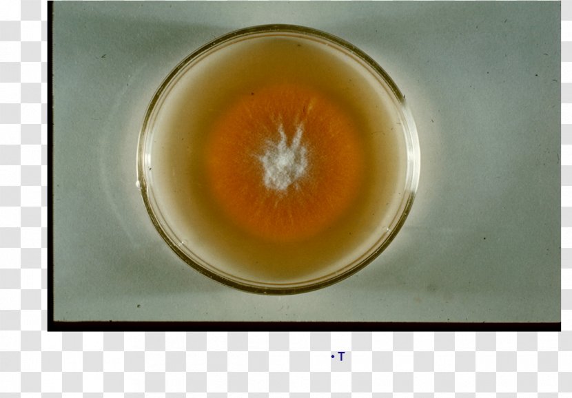 Microsporum Canis Subcutaneous Tissue Tinea Capitis Ringworm Exothrix - Glass - Cruris Transparent PNG