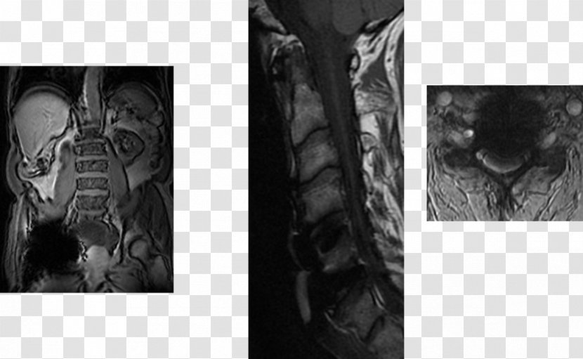 Radiology Magnetic Resonance Imaging Halswirbelsäule Anatomy Gadolinium - Physiology - Mrt Transparent PNG