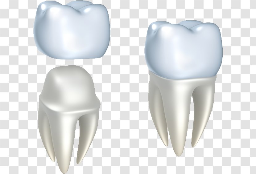 Crown Cosmetic Dentistry Dental Restoration - Silhouette - Restorative Transparent PNG