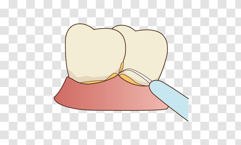 Tooth Decay 歯科 Dentist Periodontal Disease - Heart - View Transparent PNG