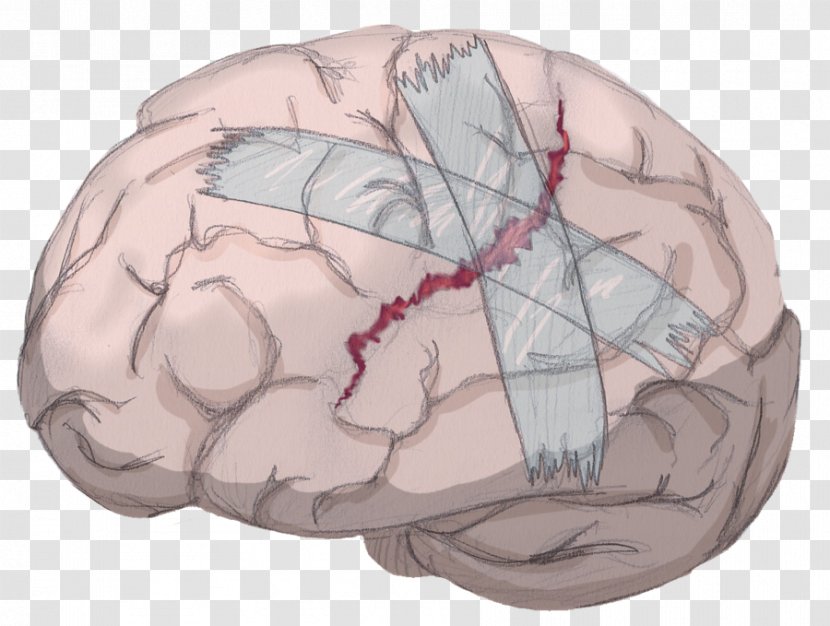 Brain Neuroimaging TV Tropes Mind Head - Frame Transparent PNG