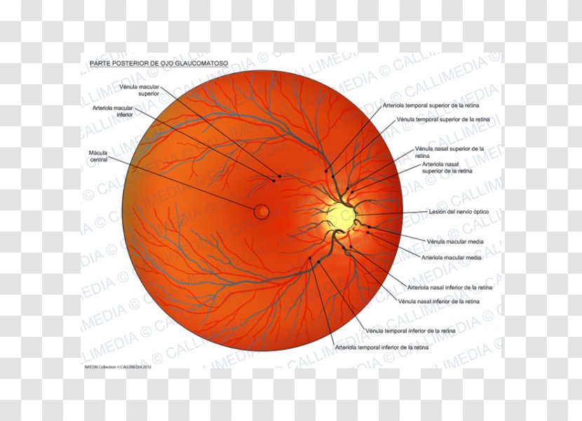 Dilated Fundus Examination Eye Glaucoma Esame Del Fondo Oculare Transparent PNG