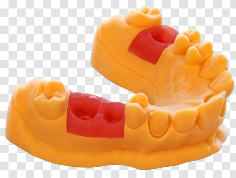 3D Printing Dentistry Printer EnvisionTEC - Orthodontics - Gum Transparent PNG