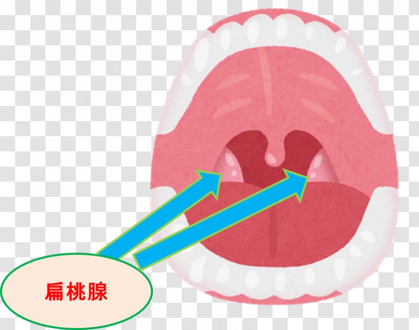 Mouth Tonsil Throat Pharynx Therapy - Otorhinolaryngology - Digestion Transparent PNG