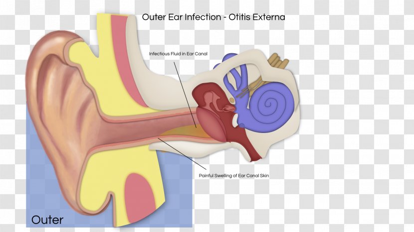 Hearing Otitis Media Vestibular Schwannoma Inner Ear - Heart Transparent PNG