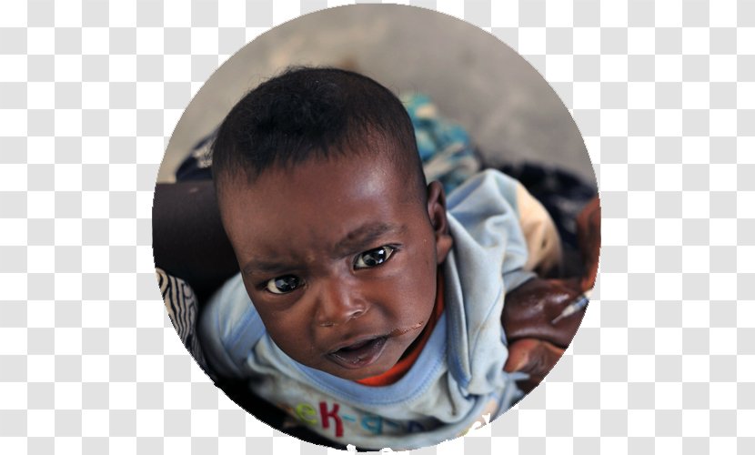 Malaria Vaccine Immunization Smallpox Rubella - Child Transparent PNG