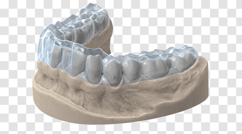 3D Scanner Tooth Computer Software Image Printing - Threedimensional Space - Occlusal Splint Transparent PNG