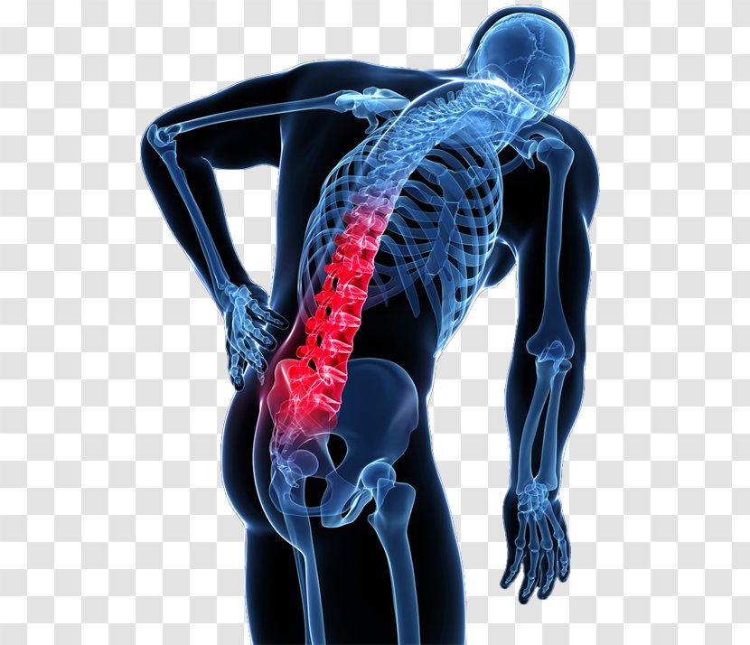 Low Back Pain Human Vertebral Column - Muscle Transparent PNG