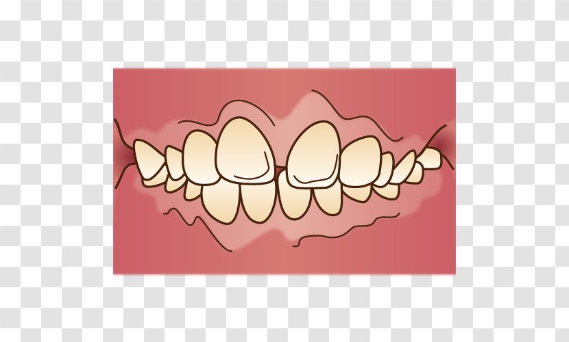 Tooth 矯正歯科 Dentist Dental Braces - Frame - Orthodontics Transparent PNG