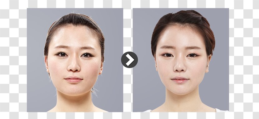 Zygomatic Bone Eyebrow Surgery Nose Cheek - Hair Coloring - Slimming Transparent PNG