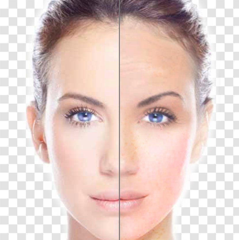 Radio Frequency Skin Tightening Care Photorejuvenation Chemical Peel - Head - Face Transparent PNG