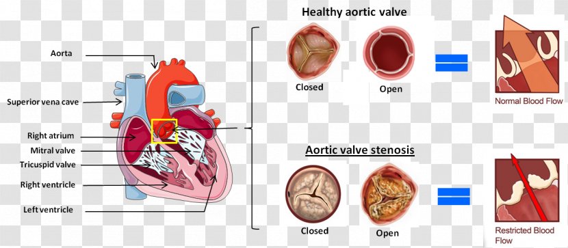 Muscle Heart Homo Sapiens Transparent PNG
