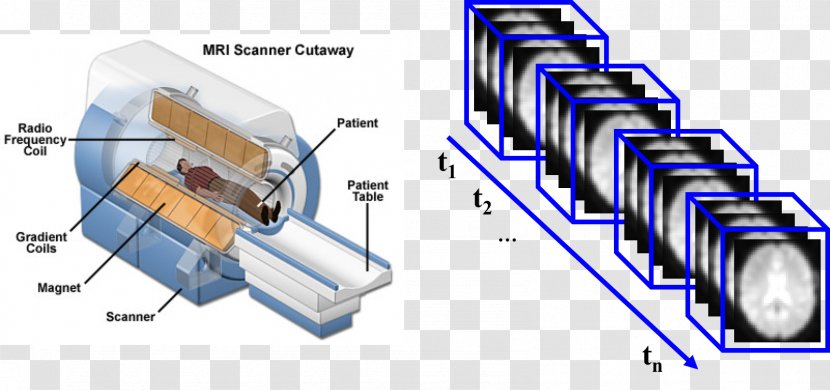Magnetic Resonance Imaging Medical Computed Tomography MRI-scanner Radiology - Engineering - Alzheimer's Disease Transparent PNG