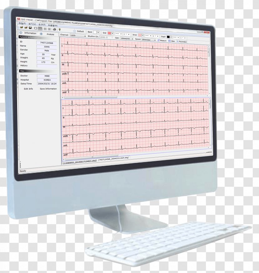 Artun Medikal Teknik Servis Electrocardiography Spirometer Pulmonary Function Testing Vital Capacity - Technology Transparent PNG