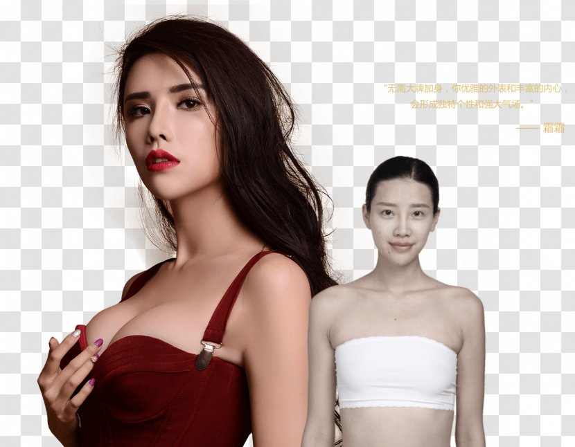 Peng'ai Cosmetology Orthopaedic Hospital Beauty Shoulder Student Plastic Surgery - Cartoon - Angelababy Transparent PNG