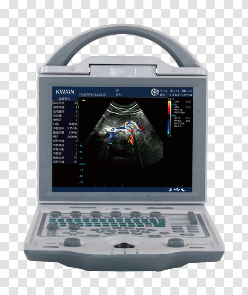 Ultrasonography Ophthalmology Equine Ultrasound Doppler Echocardiography - Animal - Ultra Sound Transparent PNG